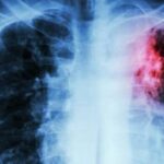 Μεταβιβάσεις ακινήτων:  Αυτόματα στο Ε9 ο ΚΑΕΚ για αγοραπωλησίες, δωρεές και γονικές παροχές